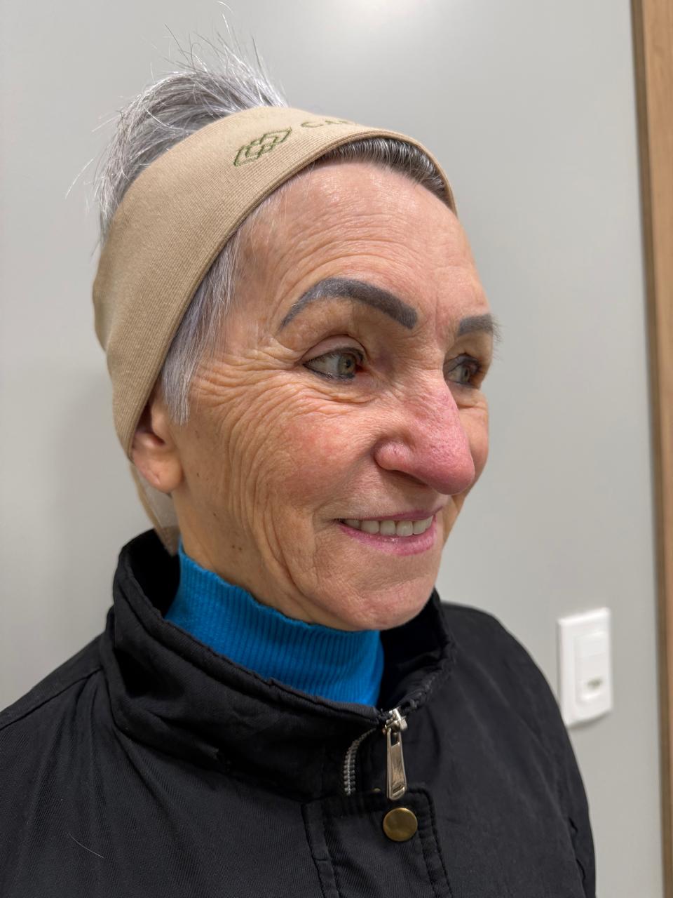 Caso 4: registro antes do cuidado facial