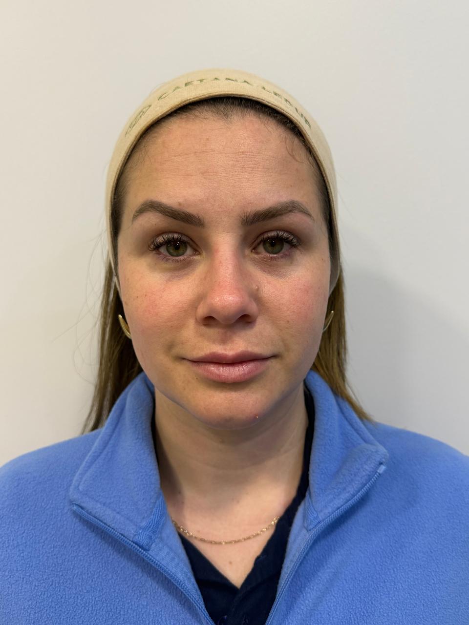 Caso 5: registro antes do cuidado facial