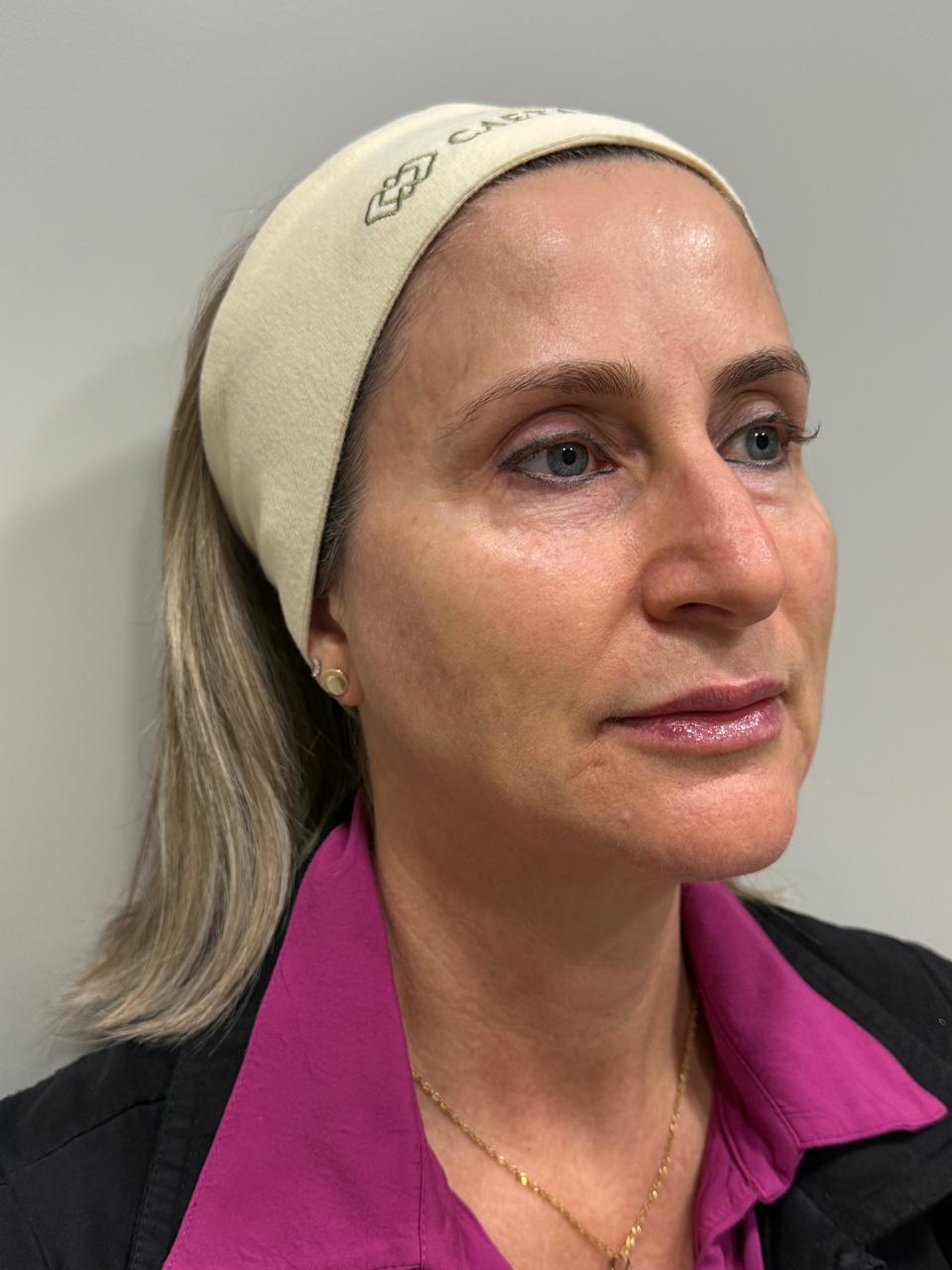 Caso 6: registro antes do cuidado facial