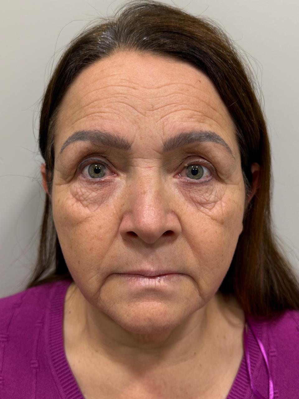 Caso 7: registro antes do cuidado facial